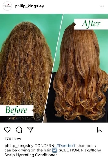 philipkingsley-before-and-after-instagram